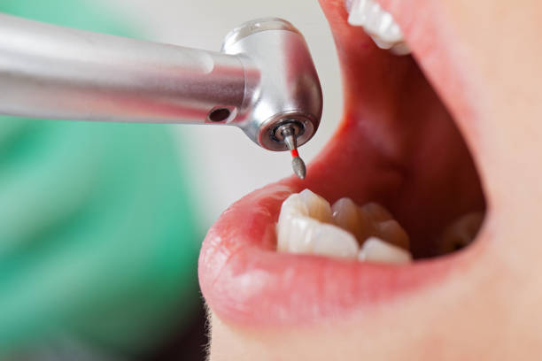Best Emergency Dental Extractions in Trafford, PA